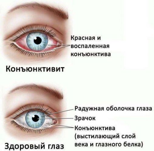 Чешутся глаза и опухают веки: причины, шелушится веко, почему