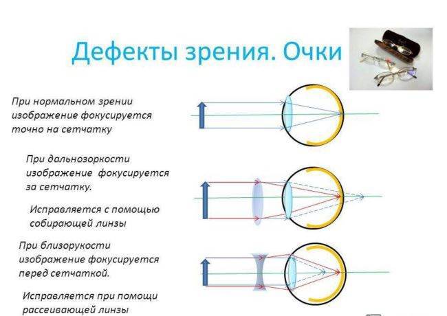 Прогрессивные линзы