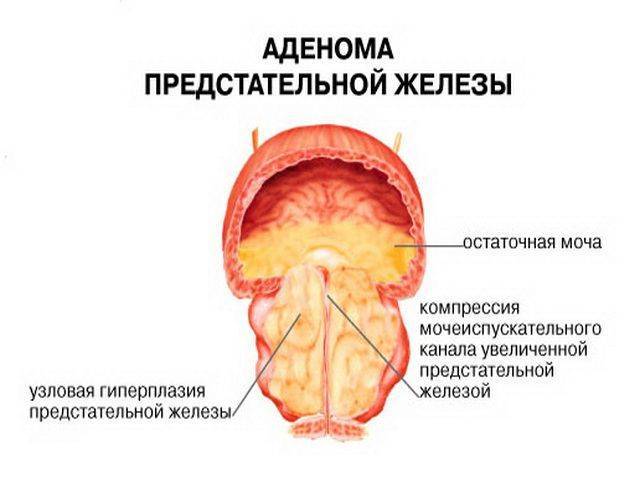 Простагут Форте                                            Prostagutt Forte                                                                инструкция по применению