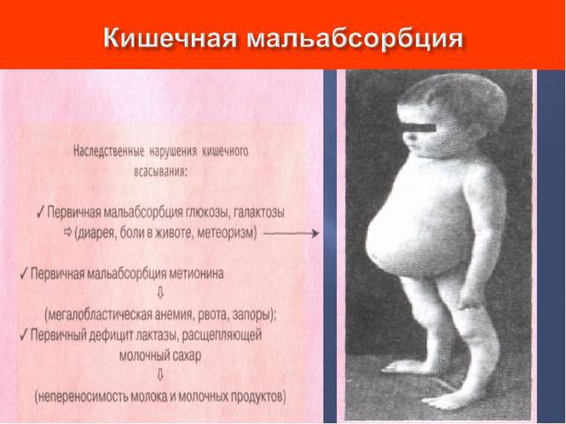 Карсил для лечения печени