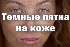 Синяки на теле без причины у женщин и у мужчин