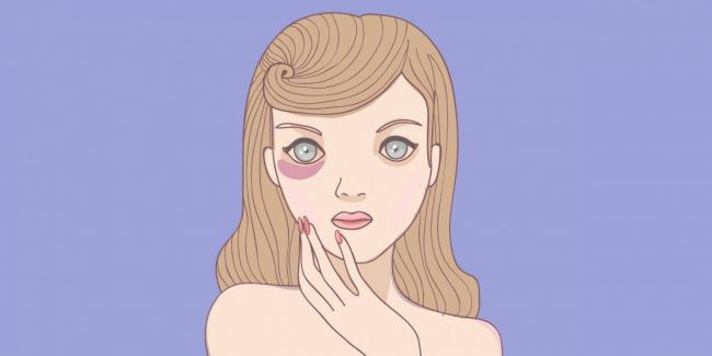 “синяки без причины на ногах у женщин: почему появляются и, что делать?”