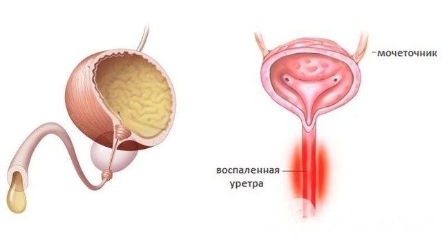 Инструкция по применению препарата урисан с отзывами и ценами