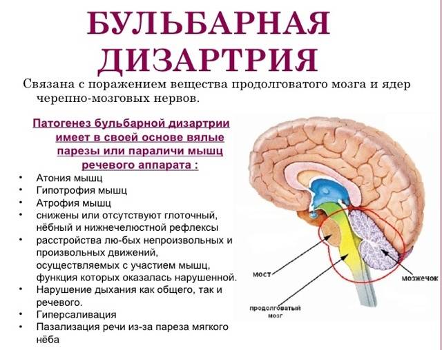 Дизартрия у детей – что это такое, как лечить?