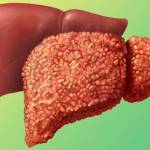 Противовирусные препараты при гепатите C: отзывы о терапии