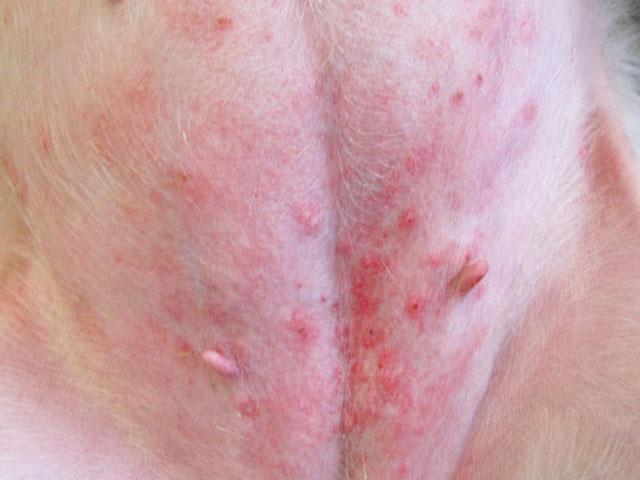 Аллергический дерматит