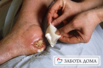 Как и чем избавиться от пролежней?