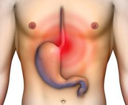 Жжение в горле - причины возникновения симптома, диагностика возможных заболеваний и их лечение