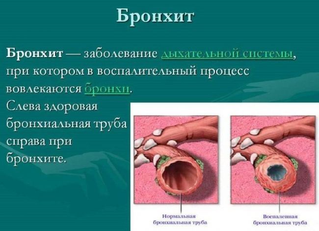 Как курение табака влияет на органы дыхания и какие заболевания дыхательной системы вызывает?