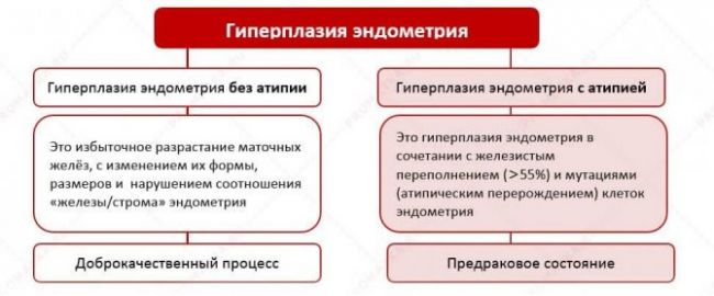 Гиперплазия эндометрия