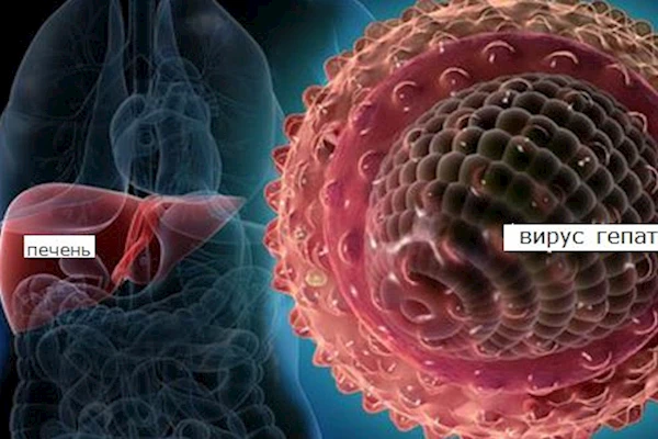 Гепатит: симптомы, причины, лечение