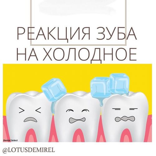 Какие продукты питания полезны для зубов