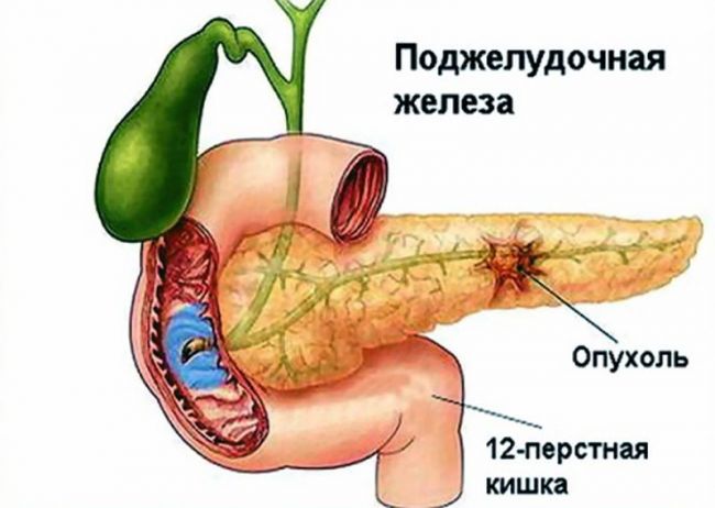 Препараты для лечения печени и поджелудочной железы и желчного пузыря
