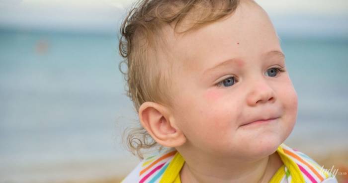 Аллергический дерматит у детей — фото, лечение, симптомы и причины