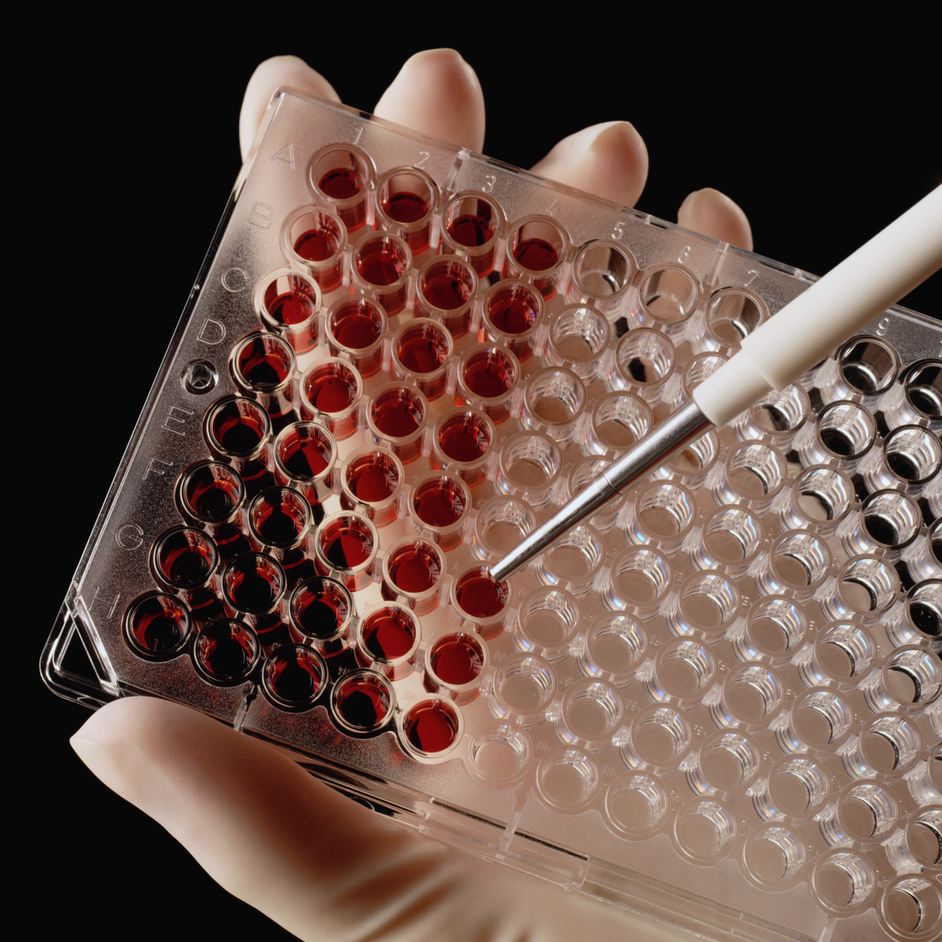 Анализ крови на биомаркеры