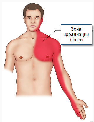 Боль различной локализации