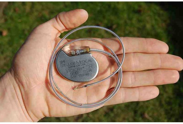 Кардиостимулятор