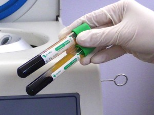 Методика центрифугирования крови