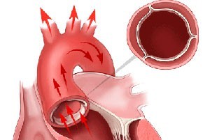 Общие сведения о заболевании