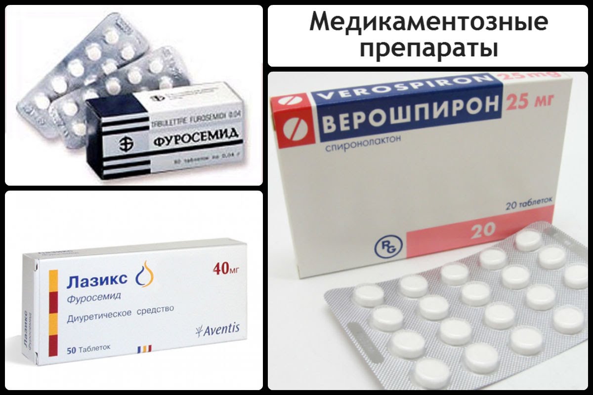 Основные методы лечения заболевания