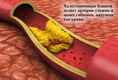 Особенности развития заболевания