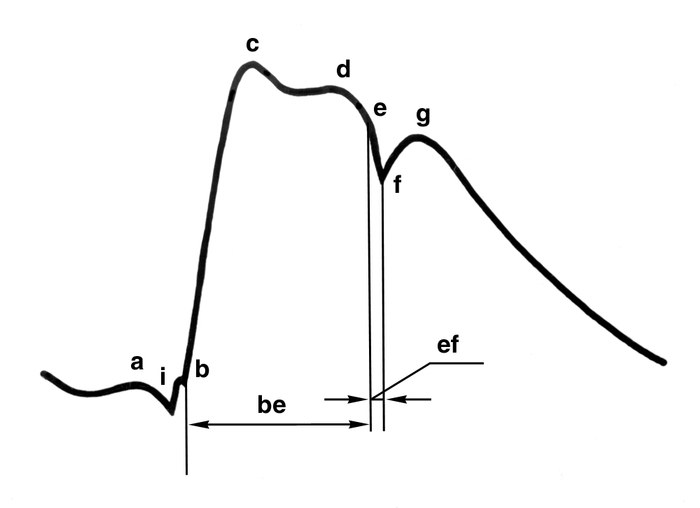 Сфигмография