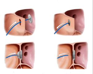 Современные подходы к лечению