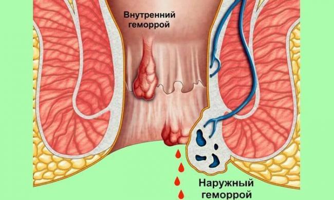 Релиф мазь инструкция по применению