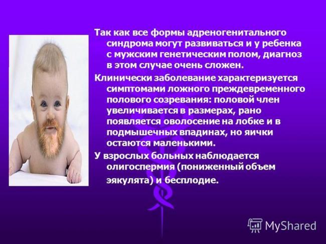 Адреногенитальный синдром