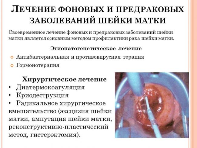 Почему на шейке матки появляются декубитальные язвы и как их лечить