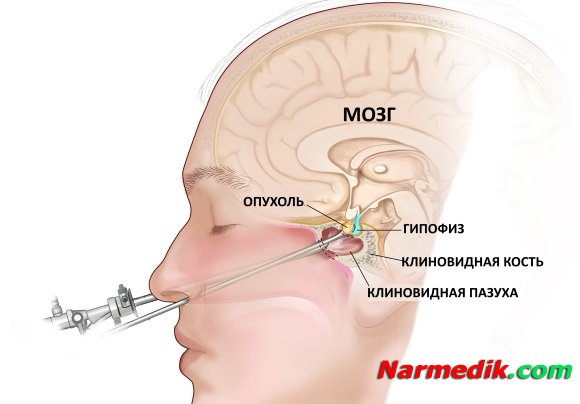 Аденогипофиз