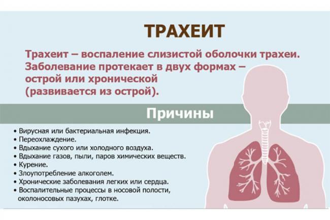 Ларинготрахеит у взрослых — симптомы и лечение