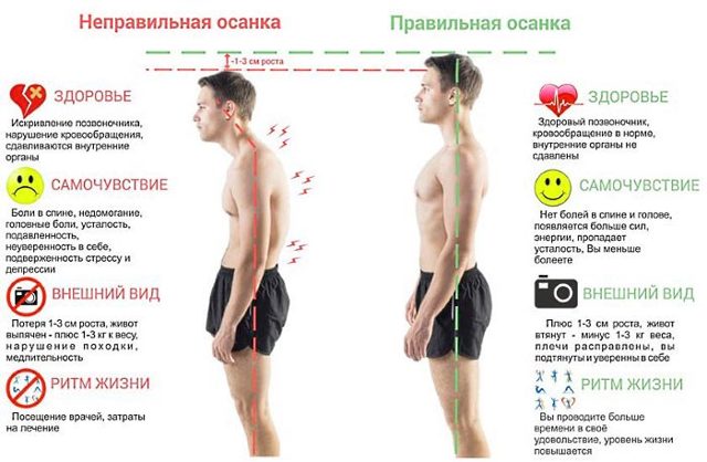 Упражнения при кифозе шейного отдела