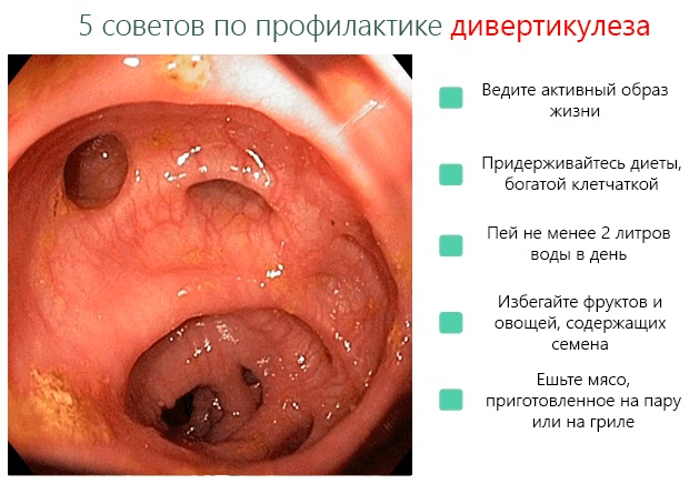 Послеоперационный период после операции на кишечнике