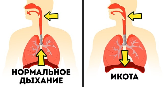 Какие средства помогут быстро избавиться от икоты в домашних условиях