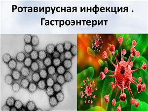 Гастроэнтерит: причины, симптомы и лечение