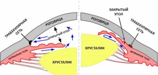 Симптомы глаукомы на ранних стадиях