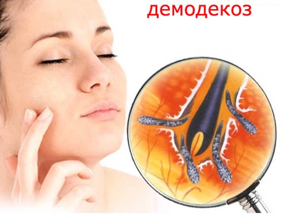 Особенности питания при демодекозе