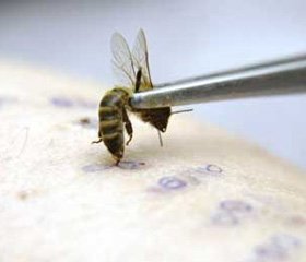 Пчелиный яд. целебные свойства пчелиного яда