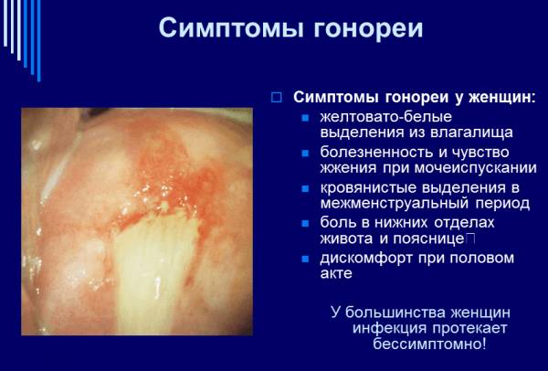 Гонорея