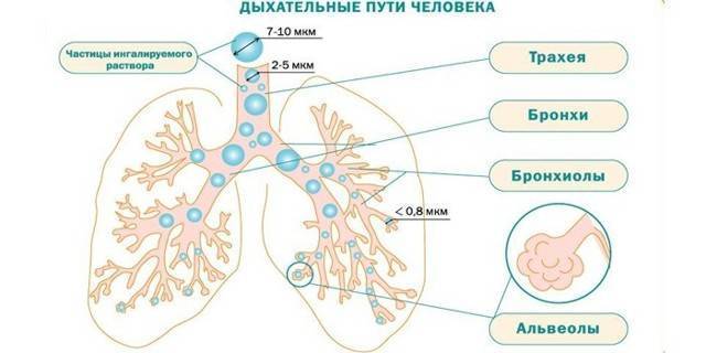 Разновидности ингаляций при пневмонии