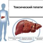 Что такое гепатит: симптомы и лечение заболевания в разной форме