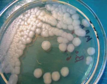 Bacillus cereus таксономия, характеристика, морфология, среда обитания / биология | thpanorama - сделайте себя лучше уже сегодня!