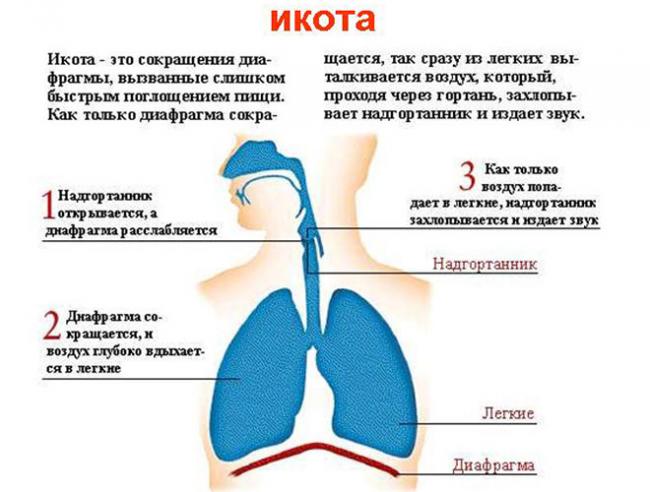 Причины икоты у взрослых: как остановить и устранить икоту