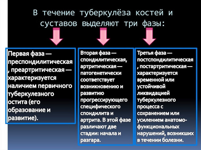 Спондилит позвоночника – признаки, симптомы и лечение болезни