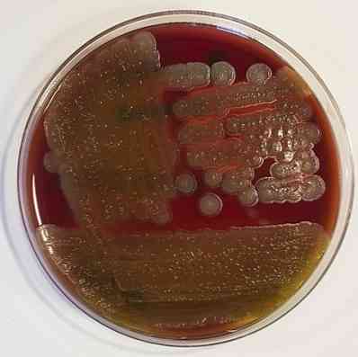 Идентификация бактерий bacillus cereus на основе их фенотипической характеристики