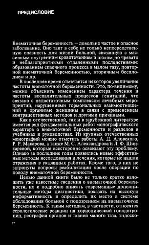 Внематочная беременность, эктопическая беременность