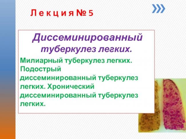 Острый милиарный туберкулез легких - симптомы болезни, профилактика и лечение острого милиарного туберкулеза легких , причины заболевания и его диагностика на eurolab