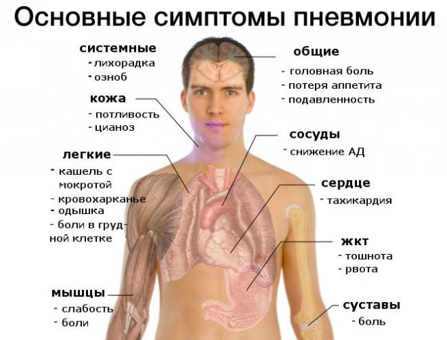 Е. комаровский: пневмония у детей, симптомы и лечение воспаления легких
