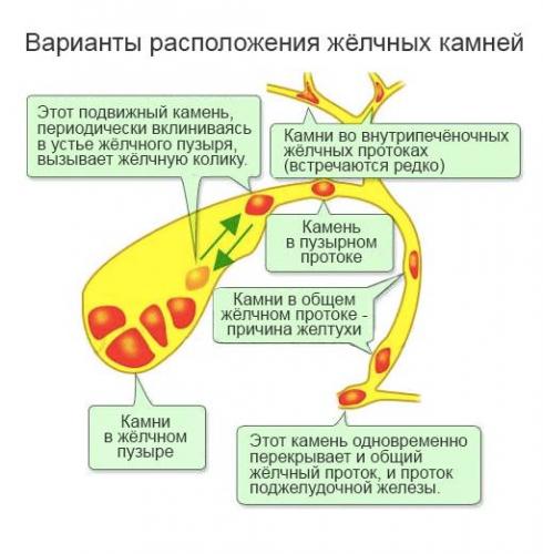 Болезнетворными бактериями являются